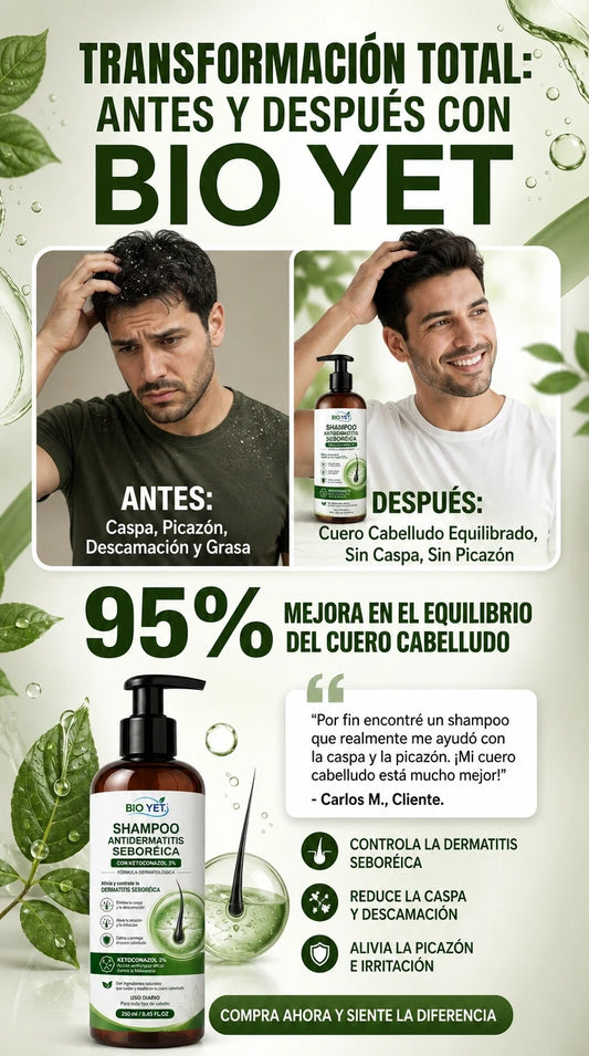 Shampoo Dermatitis Seborreica